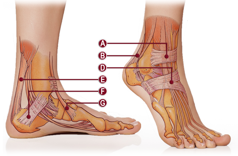 Labeled anatomy diagram of the ankle and foot showing medial and lateral views with callouts A through G identifying key ligaments, tendons, and bones — illustrated reference for ankle sprain, instability, and foot injury