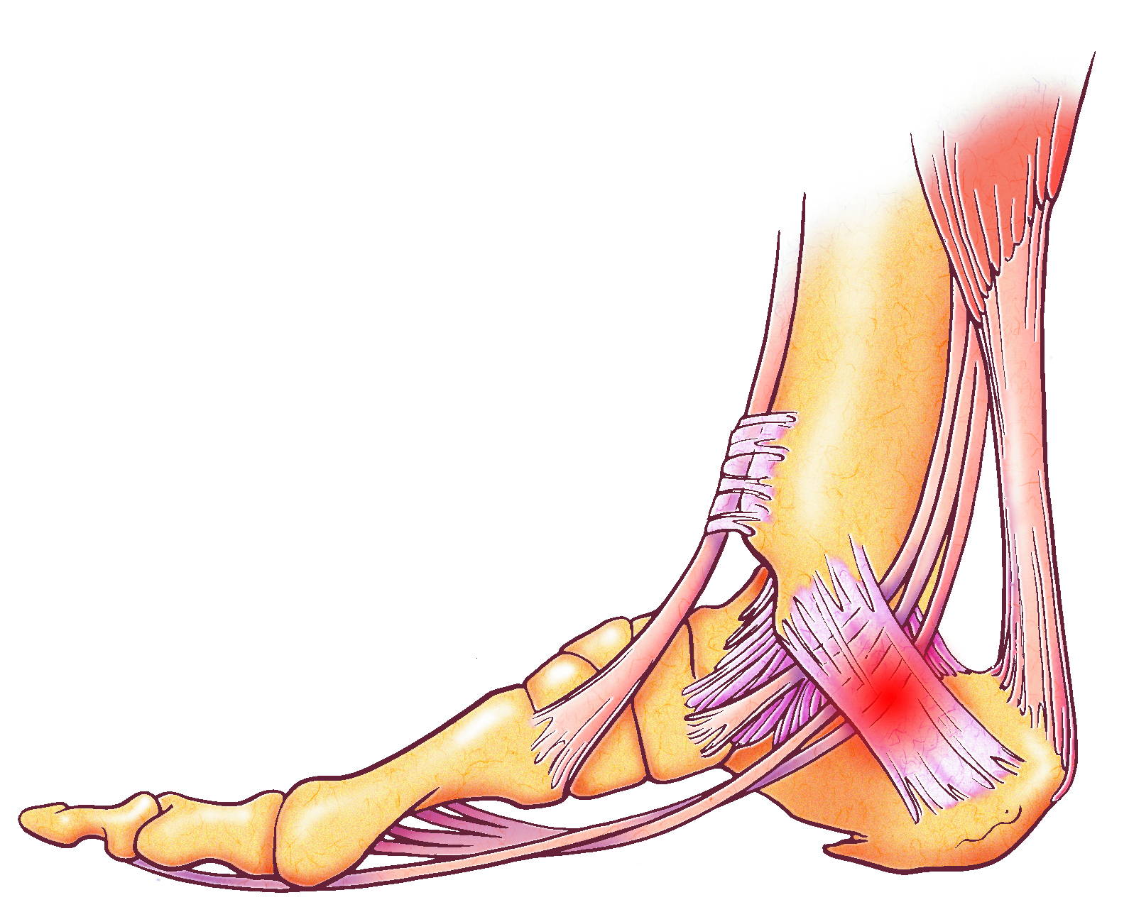 Medical illustration of ankle anatomy showing ligaments, tendons, and bones with highlighted pain points in red — side view diagram for ankle sprain and instability reference