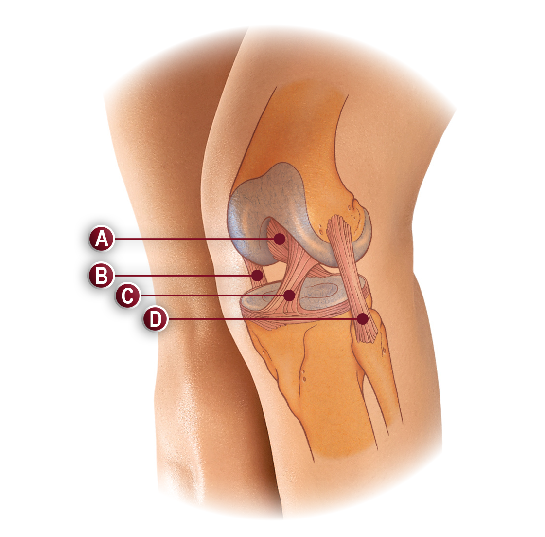 OTC 2542 Knee Stabilizer Wrap with Spiral Stays | Adjustable Orthopedic Knee Brace for ACL, MCL, Meniscus & Patella Support
