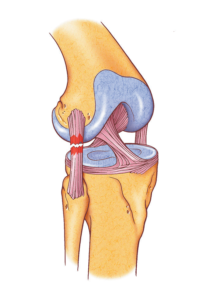 Illustrated cross-section diagram of the knee joint showing ligaments, meniscus, and patella – used with OTC KidsLine pediatric knee support – Must